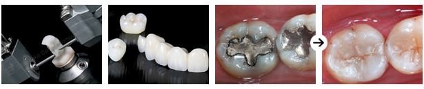 自然な仕上がり